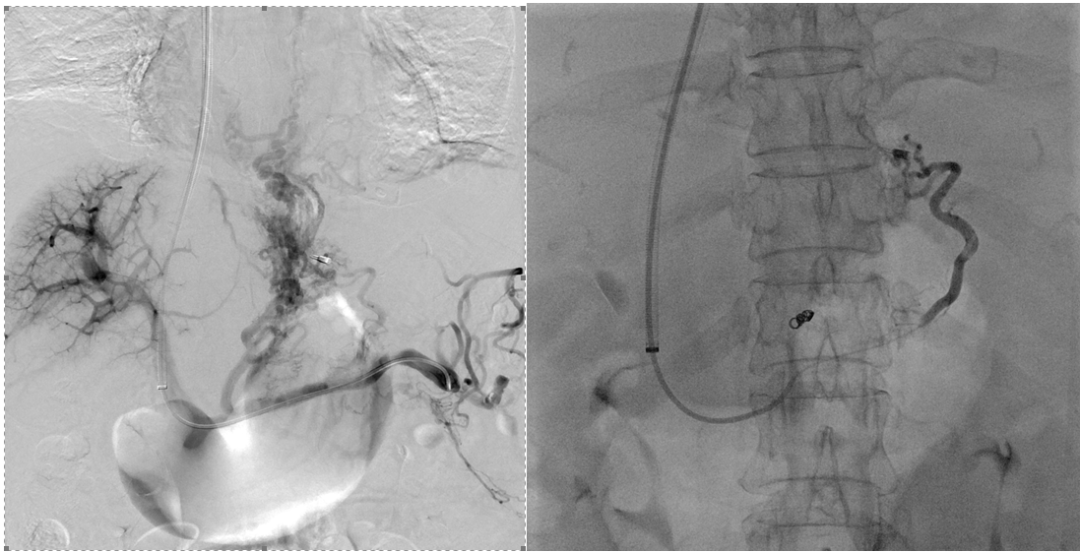 昆明市第一人民医院