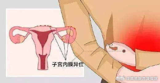 滇池旅游度假区