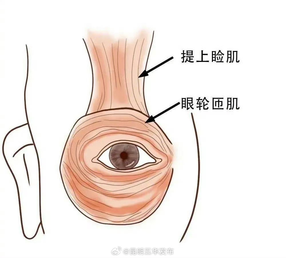 睡觉时半睁眼是正常的吗？