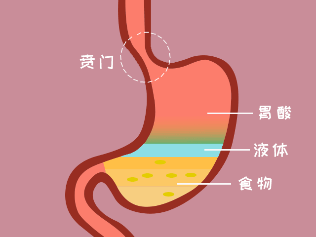 胃食管反流做好8件事