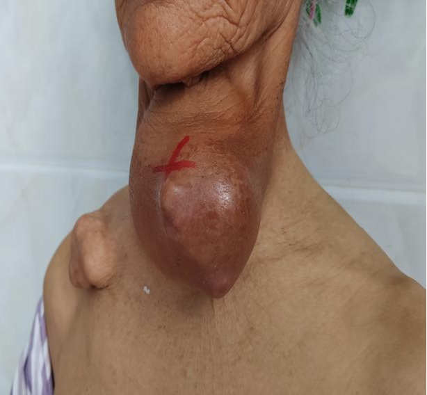 云南省文山州人民医院