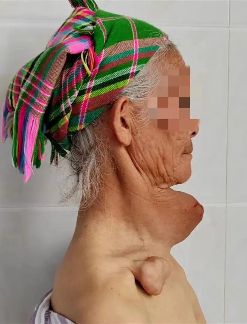 云南省文山州人民医院