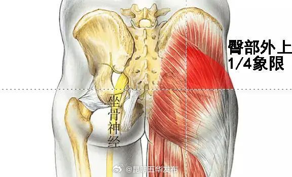 屁股针为什么消失了？