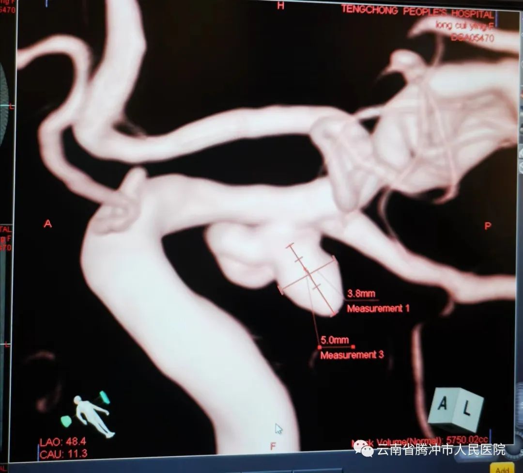 健康腾冲