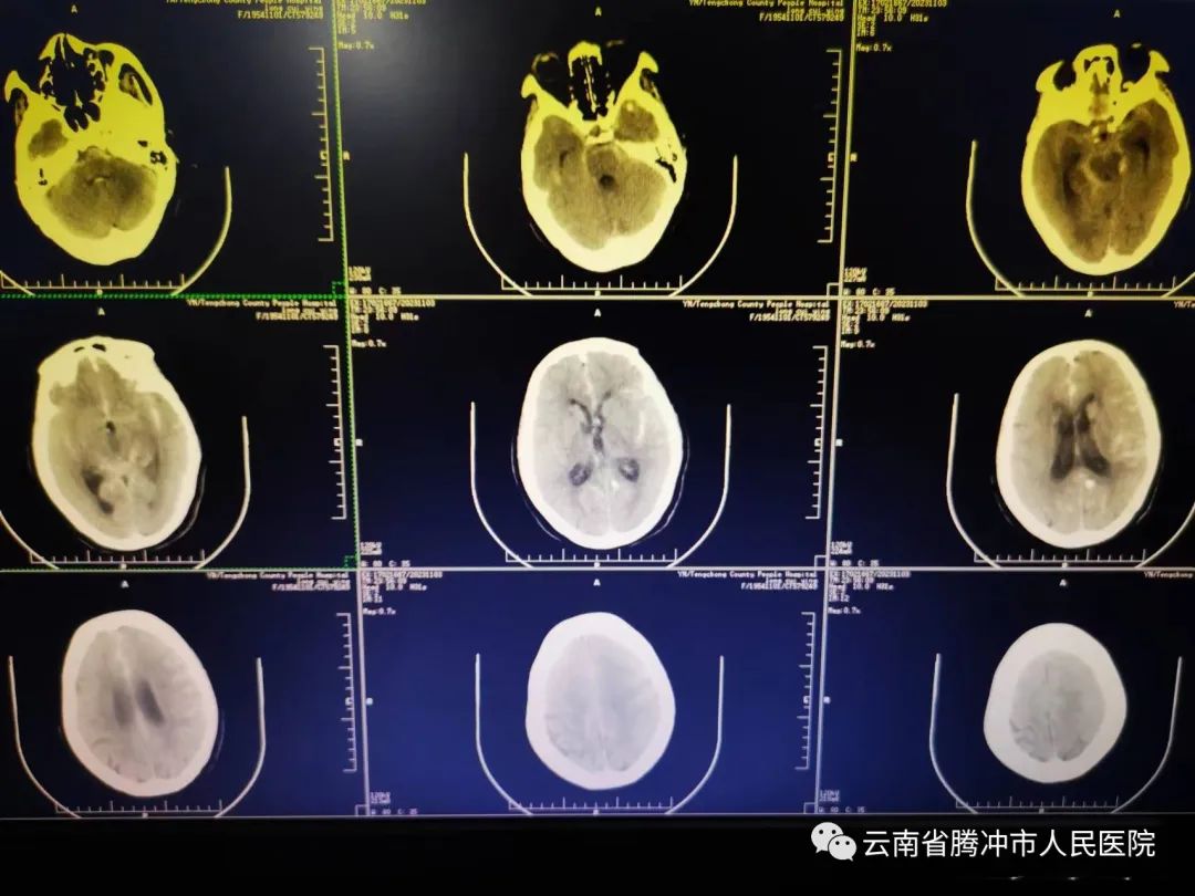 健康腾冲
