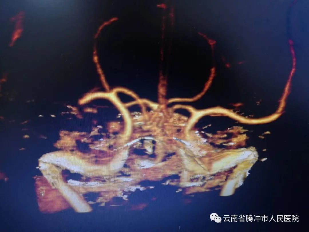 健康腾冲