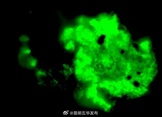 总觉得累可能长微血栓了_http://www.mainten.cn_cns_第1张