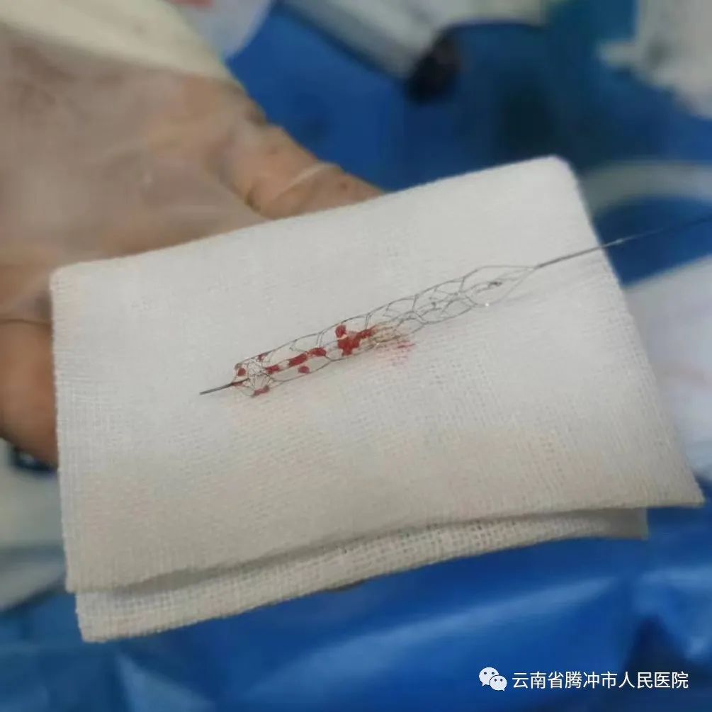 健康腾冲
