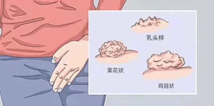 健康腾冲