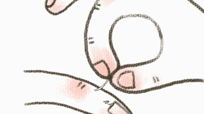 洗手太频繁也可能长倒刺