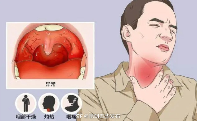 嗓子疼喝什么好得快