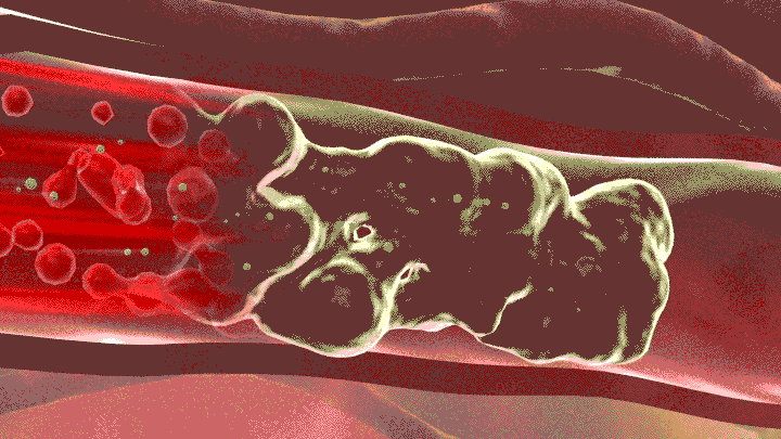 如何判断是血管问题还是单纯脚凉？