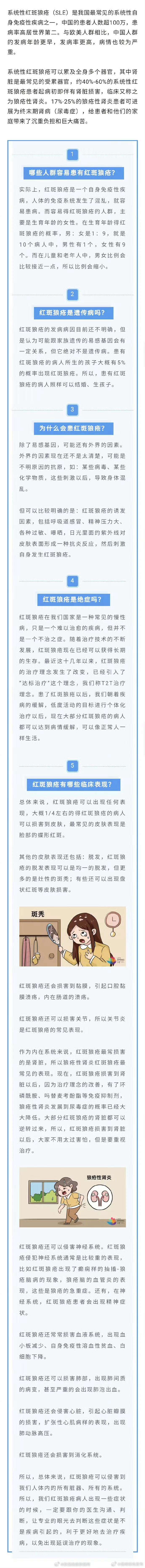 红斑狼疮高发人群是年轻女性
