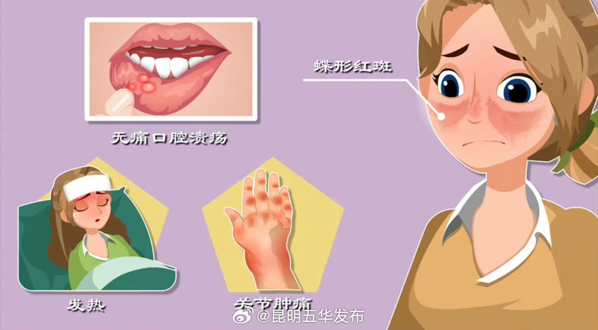 红斑狼疮到底是什么病_http://www.mainten.cn_cns_第1张