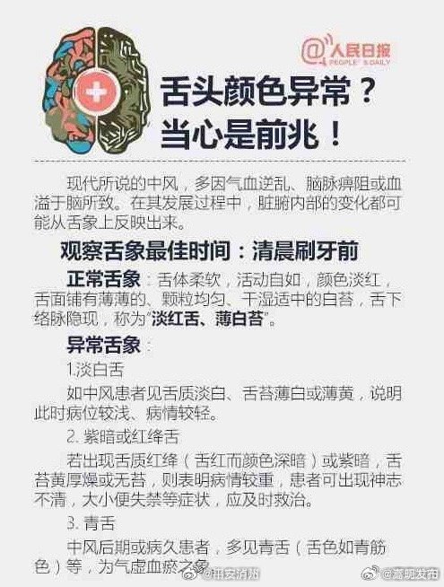 关于脑梗，知道这些能救命！_http://www.mainten.cn_cns_第3张