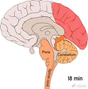 偏头痛到底是哪里在痛