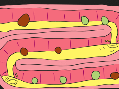 5种拉肚子要尽快看医生
