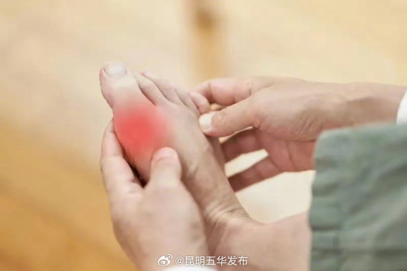 高尿酸是吃出来的吗_http://www.mainten.cn_cns_第1张