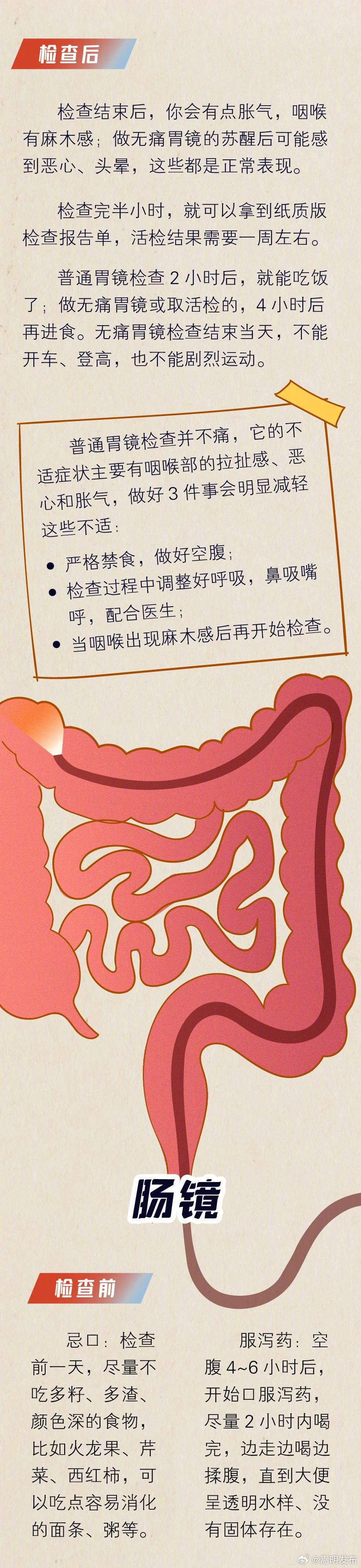 沉浸式体验胃肠镜全过程_http://www.mainten.cn_ycb_第4张