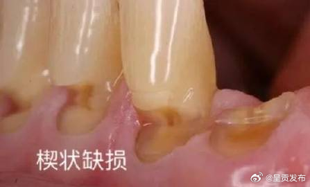呈贡发布