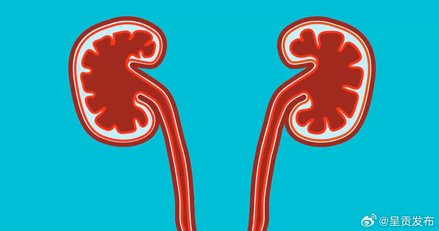 多喝水是预防肾结石最简单的办法