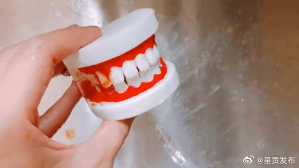 冲牙器代替不了刷牙