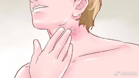 炎症和感染是什么关系