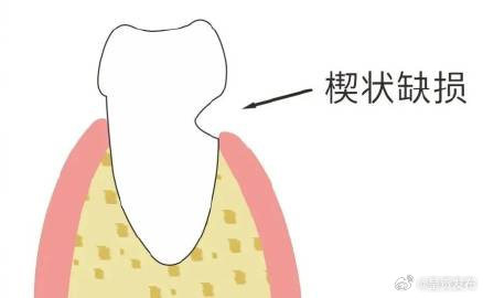 呈贡发布