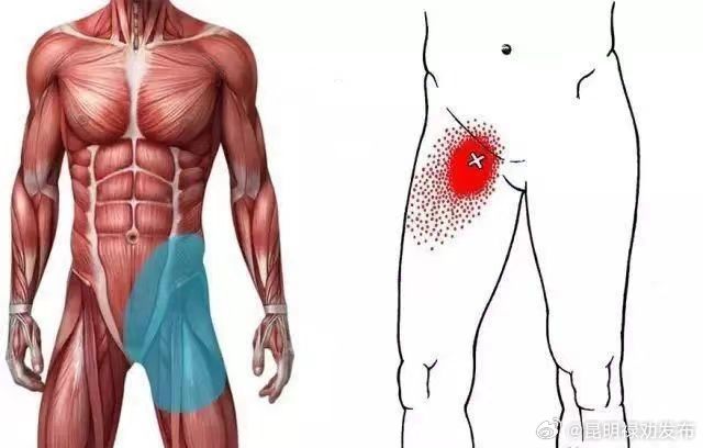 腹股沟拉伤需要休多久