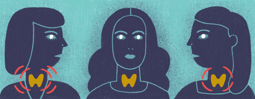 甲状腺癌的4个典型信号