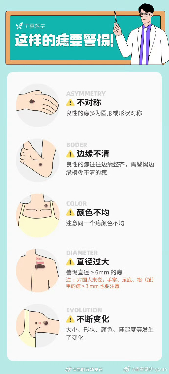 “ABCDE”法自查身上的痣是否癌变