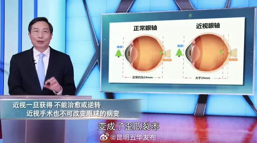 近视手术并不是治愈了近视 