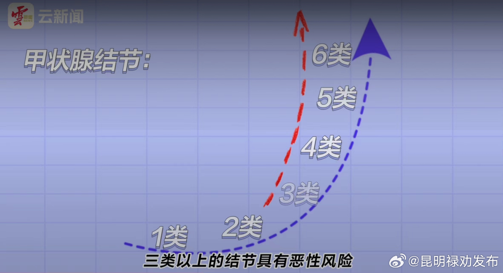 云端诊室丨体检查出甲状腺结节，是离癌症不远了吗？