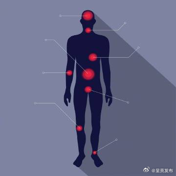 运动完第二天全身酸痛的原因