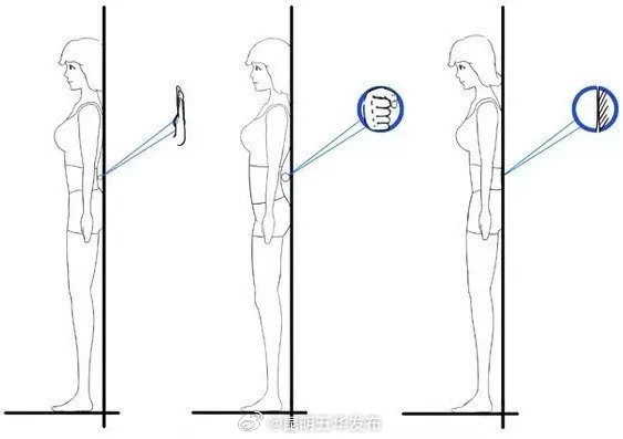 屁股扁平下垂可能是骨盆后倾