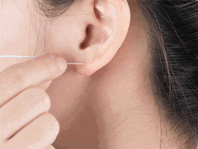 瘢痕体质的人不建议打耳洞