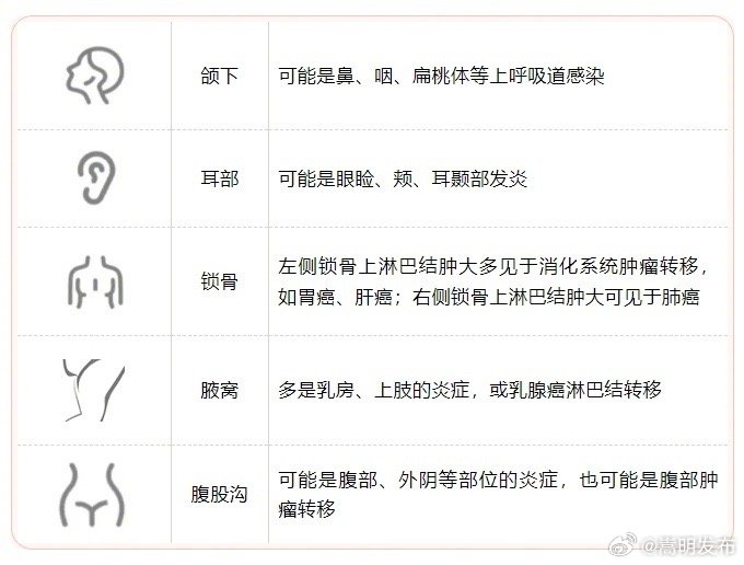 身体3处淋巴肿了当心肿瘤_http://www.mainten.cn_ycb_第1张