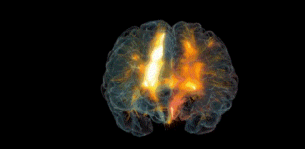 脑子里也会长结石