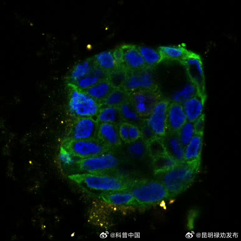 科学家发现癌细胞自毁新方式