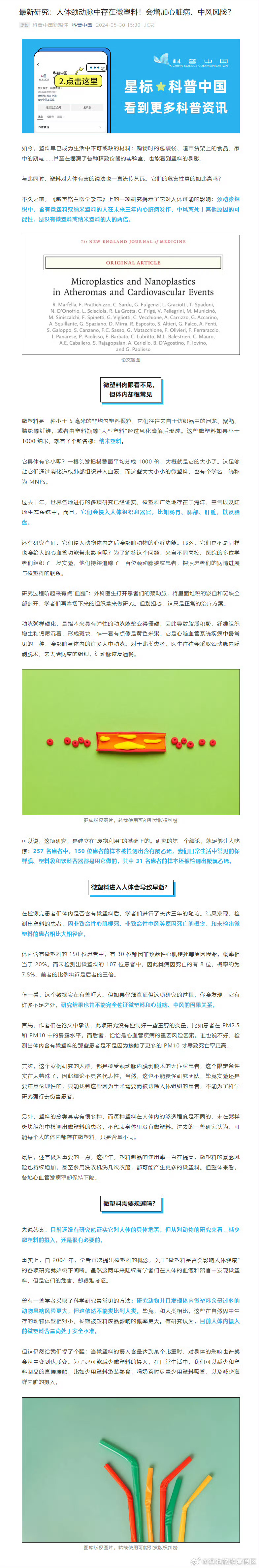 人体颈动脉中存在微塑料