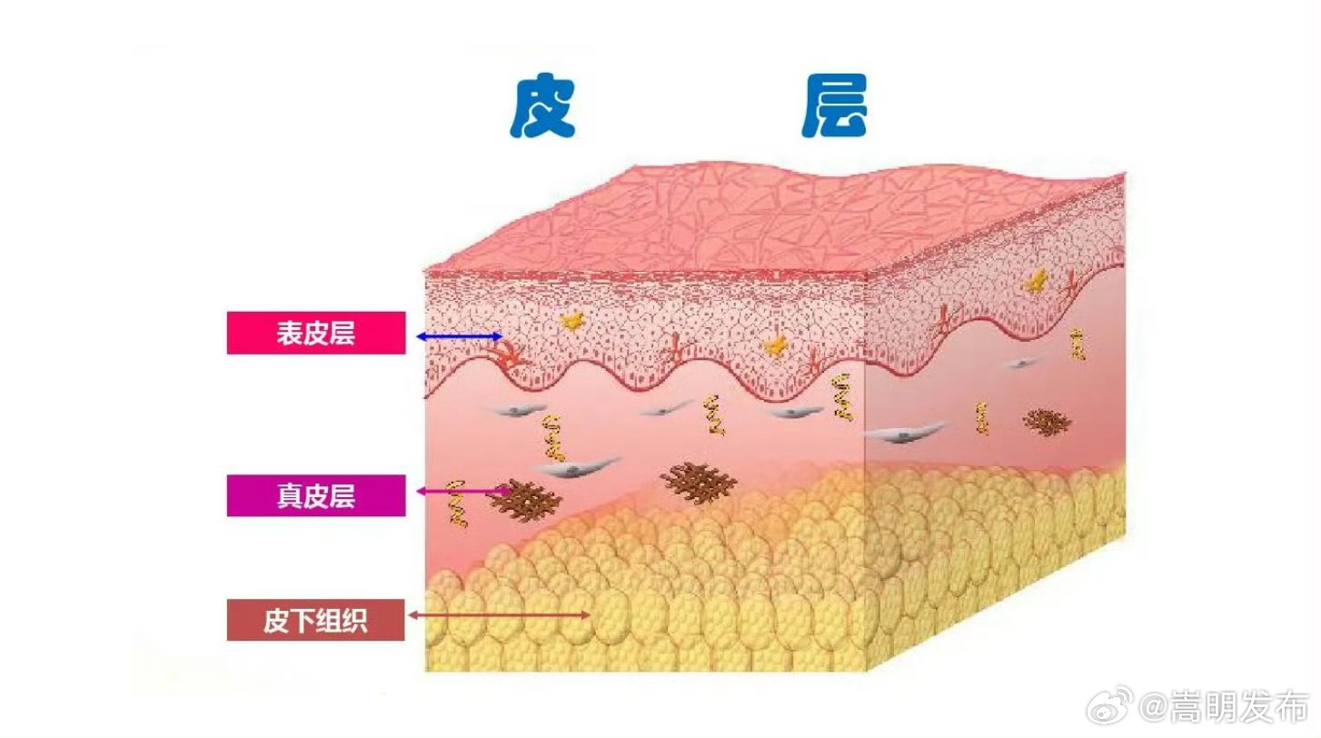 早上醒来水肿是病了吗