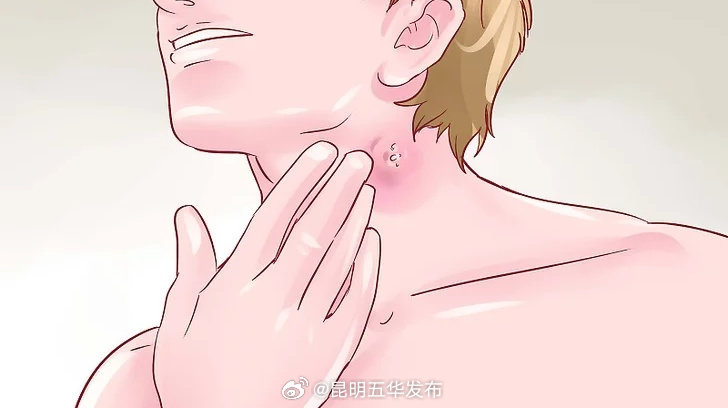 炎症和感染是什么关系