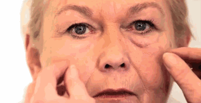 眼袋越长越大要警惕肾病