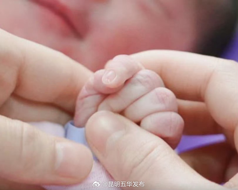 协和医生说无痛分娩不影响胎儿及哺乳