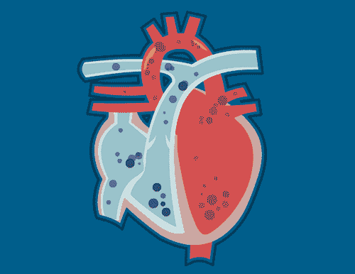 冷知识：心脏也会长结节