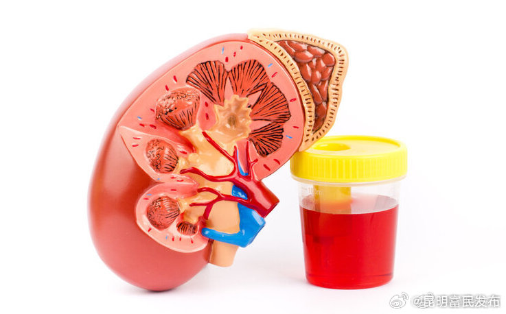 肾出现问题身体会发出这4个警报