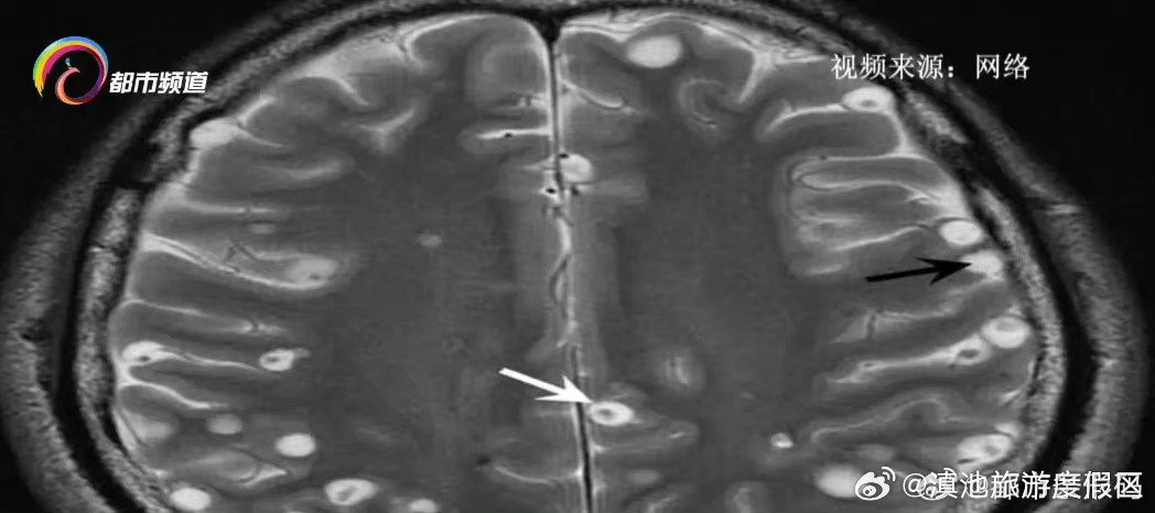 滇池旅游度假区