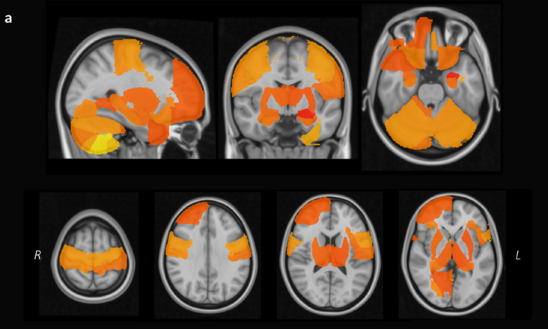 注意！长期熬夜会增加身体核心器官负担