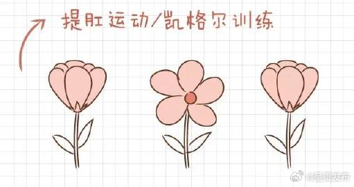 凯格尔运动的核心是找到盆底肌 