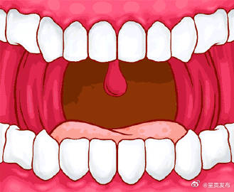 口臭可能嘴里的细菌在放屁